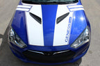 Hyundai Genesis Vinyl Stripes Kit (2013-2017) Rally Stripes - RacerX Customs